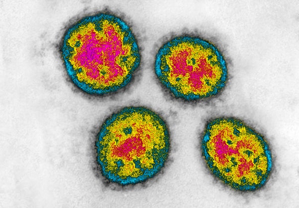 Bright colored image of lassa virus.