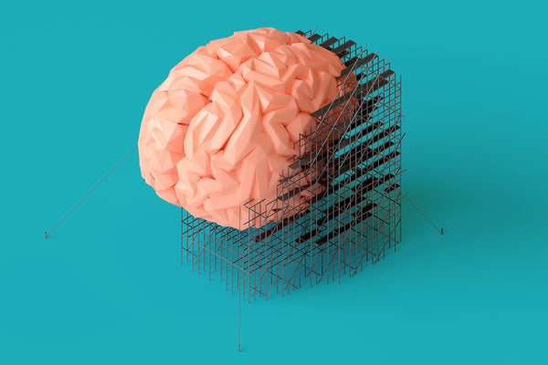Illustrated 3-dimensional artist's concept of a human brain surrounded with scaffolding as if it is under repair