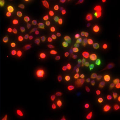 Adult Cells Steal Trick from Cancer to Become Stem Cell-Like