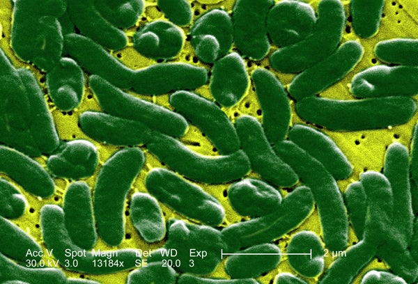 Vibrio vulnificus Bacteria - green.