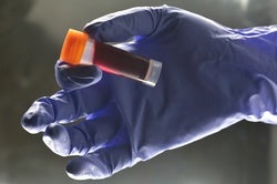 First New HIV Strain in 19 Years Identified