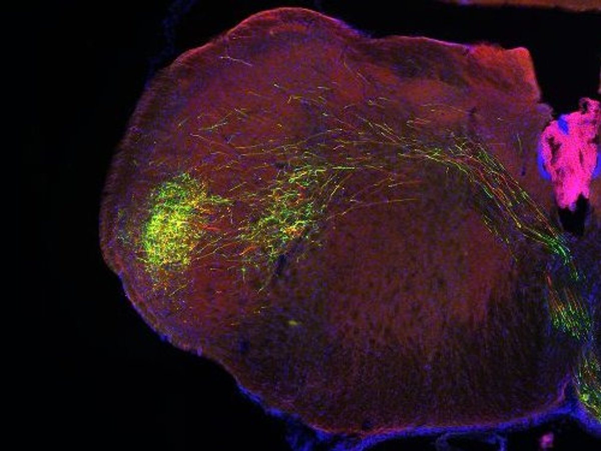Brain-Data Gold Mine Could Reveal How Neurons Compute | Scientific American