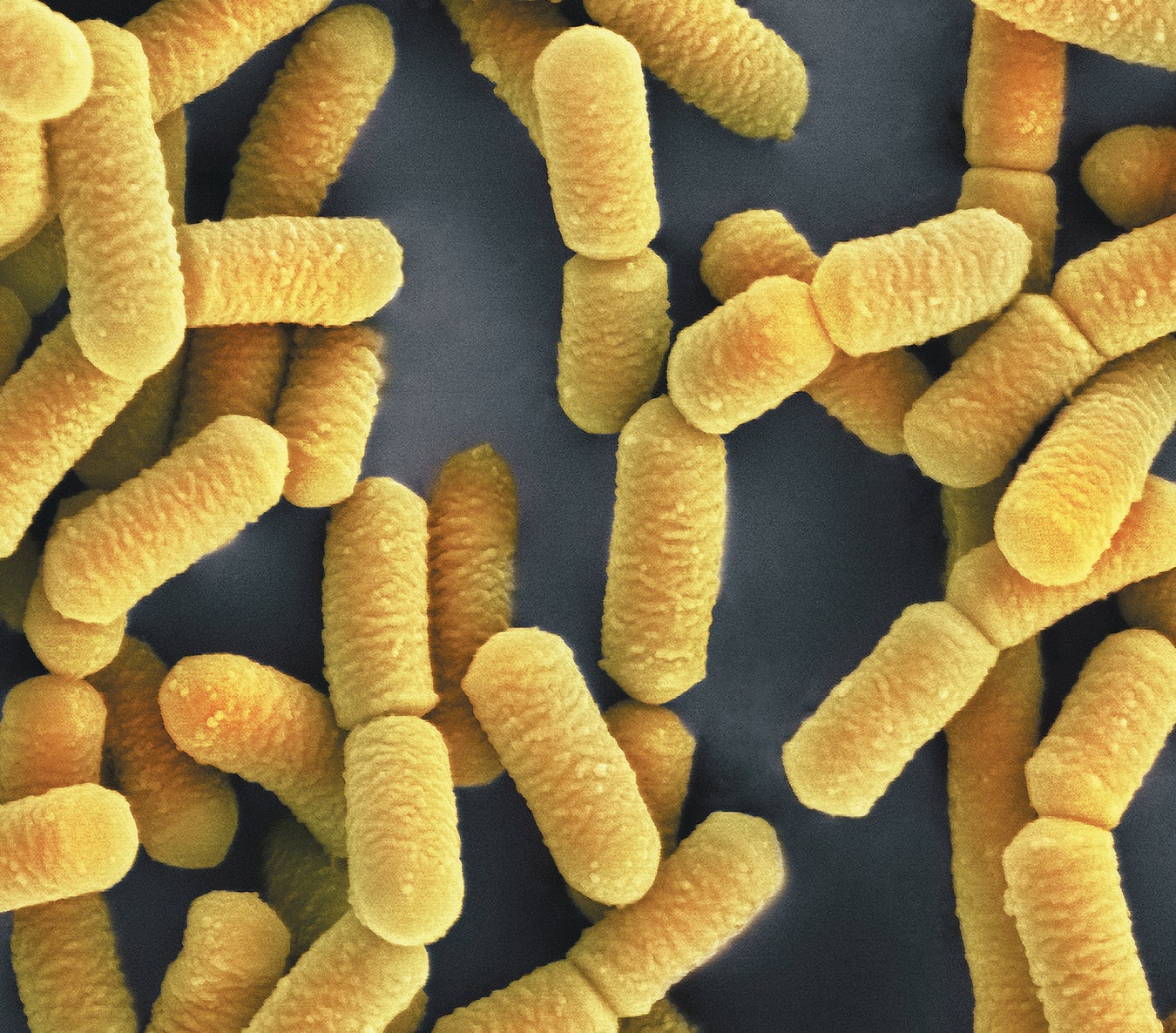 Do Probiotics Really Work? | Scientific American