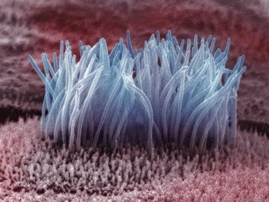 Why Scientists Are Blaming Cilia for Human Disease - Scientific American