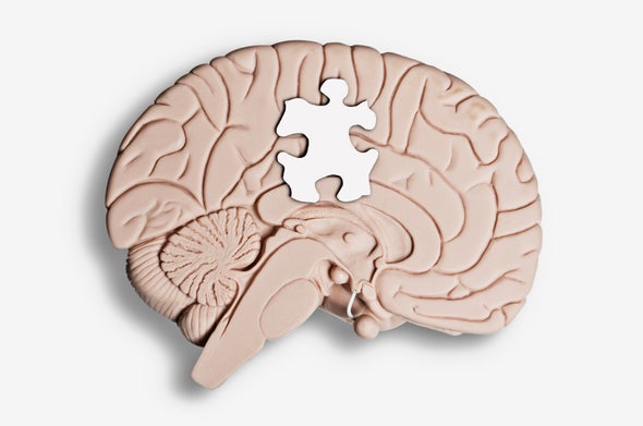 Brain Tissue Study Deepens Autism–Schizophrenia Link