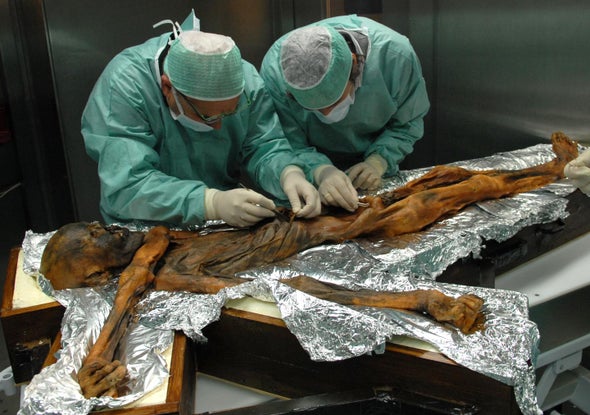 Here's What Ötzi the Iceman Ate before He Was Murdered