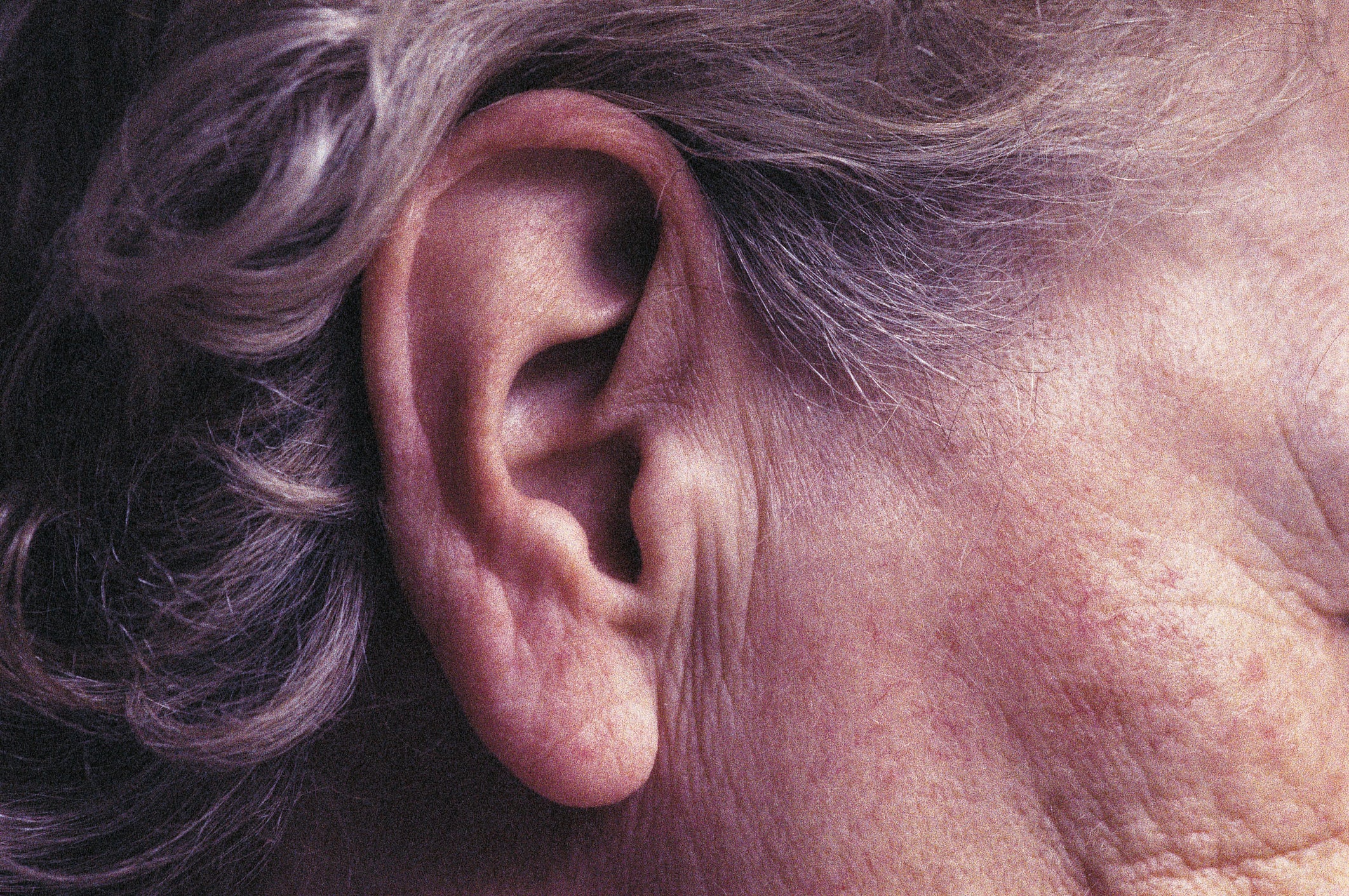 impacted ear wax headache