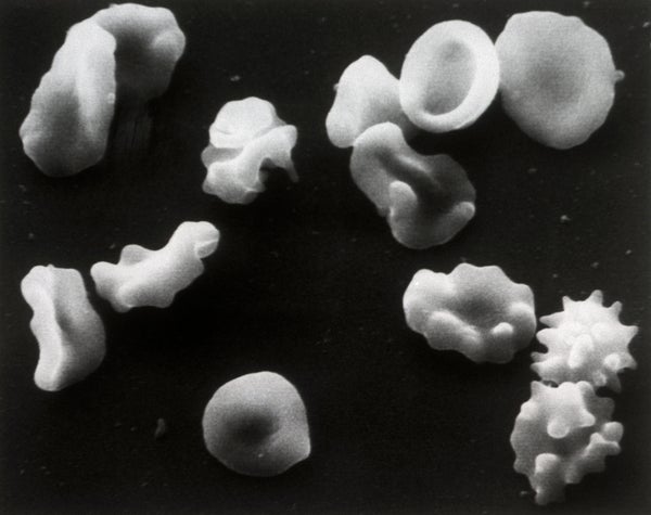 Disk-shaped and irregular white blobs against a black background.
