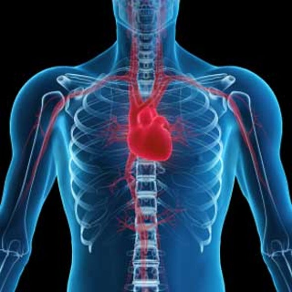 Heart-Lung Machine May Not Be the Culprit in Post-Op "Pump Head" Syndrome