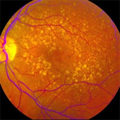 Eyewire