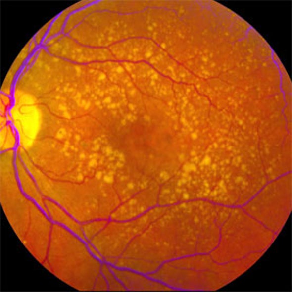 Eyewire