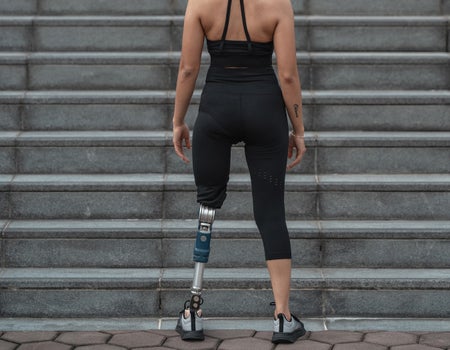 Woman with a prosthetic leg getting ready to exercise.
