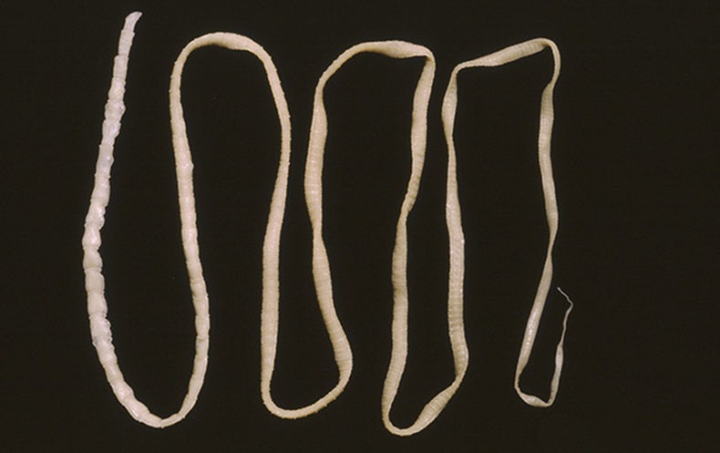 flatworms in humans