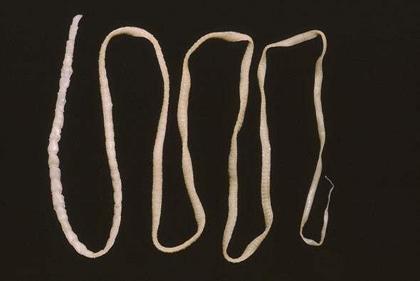 Brain-Invading Tapeworm That Eluded Doctors Spotted by New DNA Test