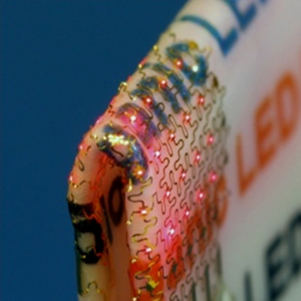 Stretchable Light-Emitting Sheets Could Form the Basis of Implantable Optoelectronics