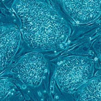 A 1996 Federal Budget Amendment Darkens the Future of Embryonic Stem Cell Research