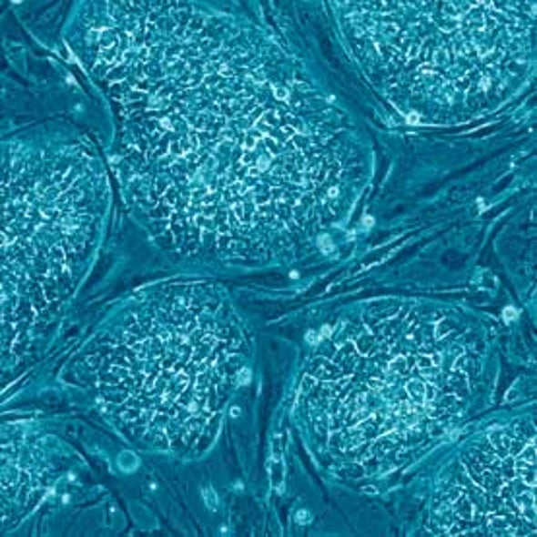 A 1996 Federal Budget Amendment Darkens the Future of Embryonic Stem Cell Research