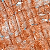 Striated Muscle