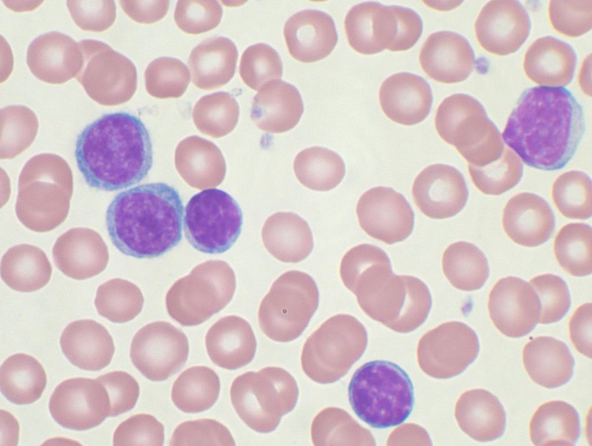 FDA Lets Cancer Trial Resume after 3 Patient Deaths | Scientific American