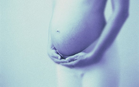 Zika Linked to a Variety of Birth Defects