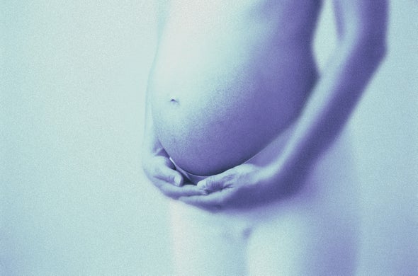 Zika Linked to a Variety of Birth Defects