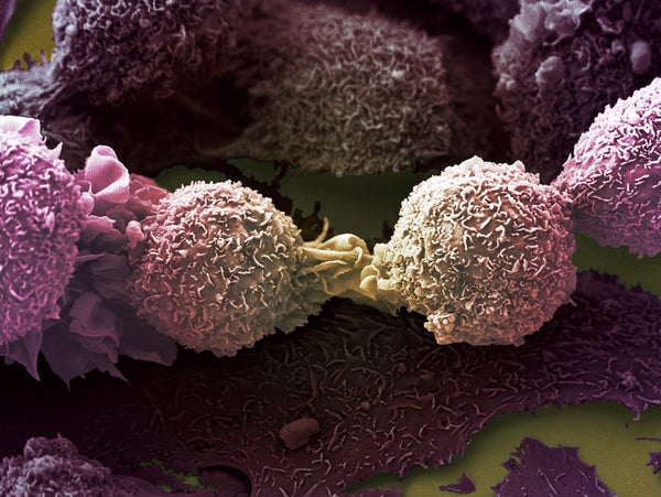 Two cancer cells dividing.