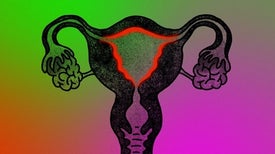 One in 10 Who Menstruate Suffer from Endometriosis. Why Do We Know So Little about It?