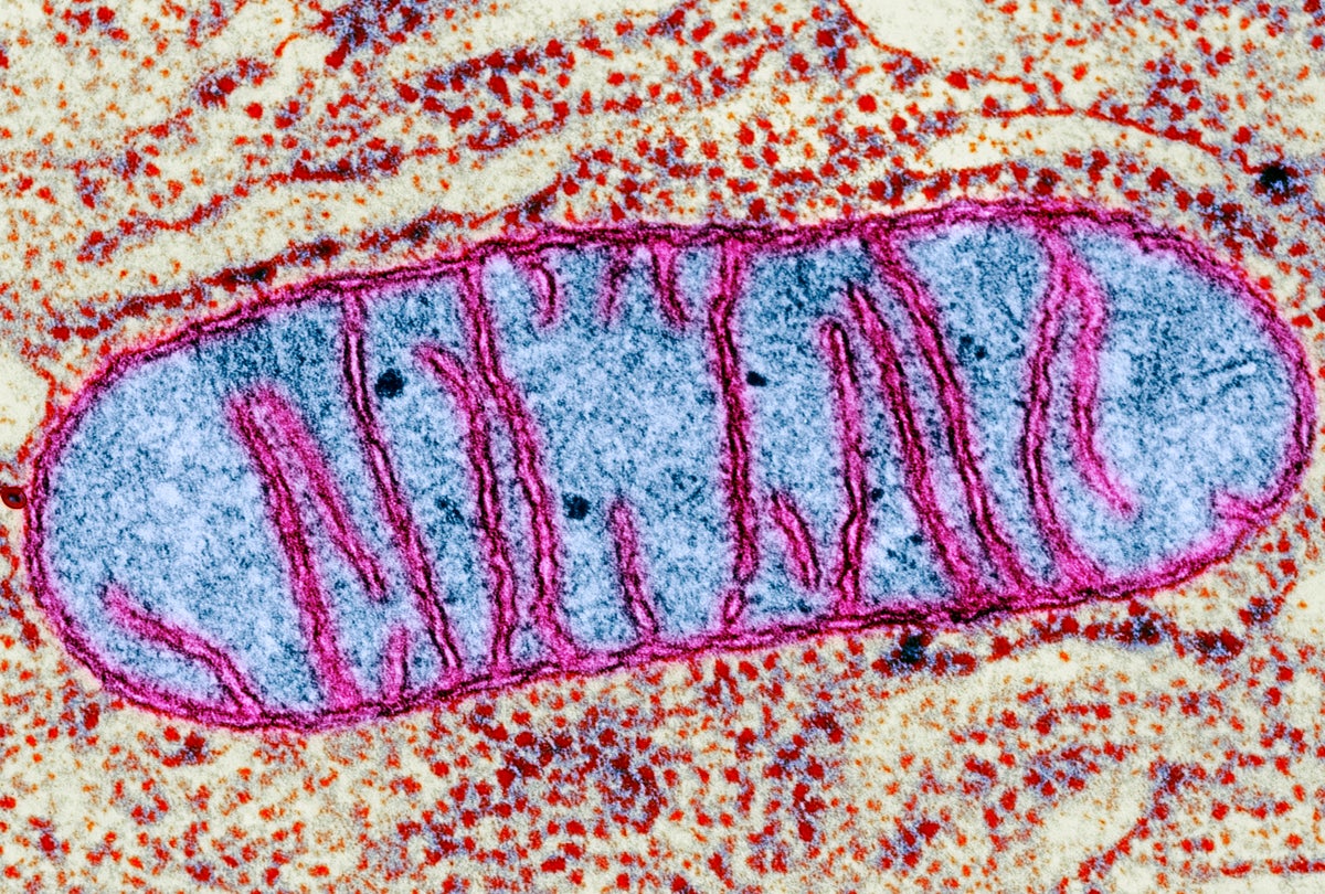 Promising Links Found between Different Causes of Parkinson's | Scientific  American