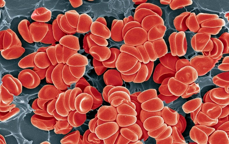 How Could A Covid Vaccine Cause Blood Clots Scientific American