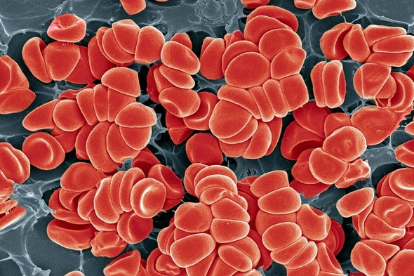 How Could a COVID Vaccine Cause Blood Clots?