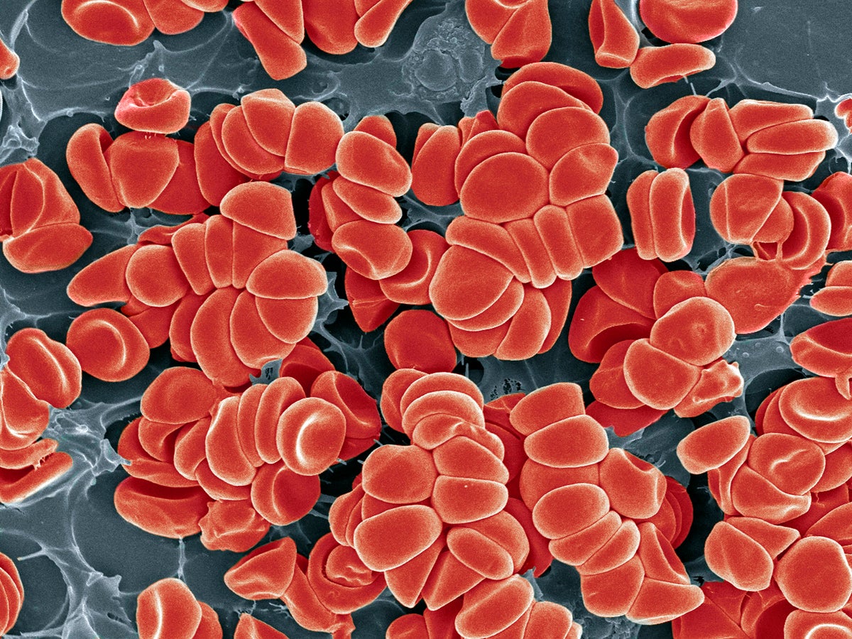 How Could a COVID Vaccine Cause Blood Clots? | Scientific American How Could a COVID Vaccine Cause Blood Clots? | Scientific American