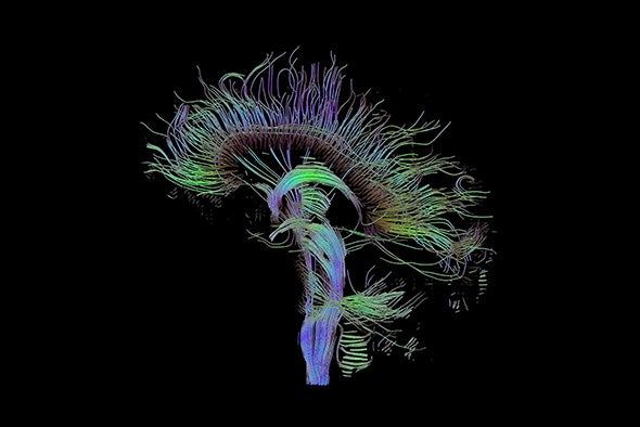 Neuroscience: Big Brain, Big Data