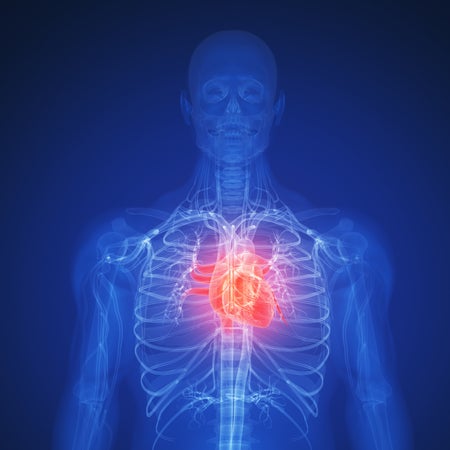 x-ray image of the heart