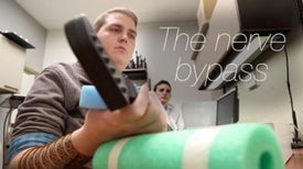 Paralyzed Man Bypasses Arm Nerves to Move Hands with His Brain