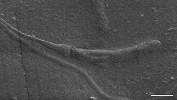 Oldest Animal Sperm Found inside Fossilized Worm Cocoon