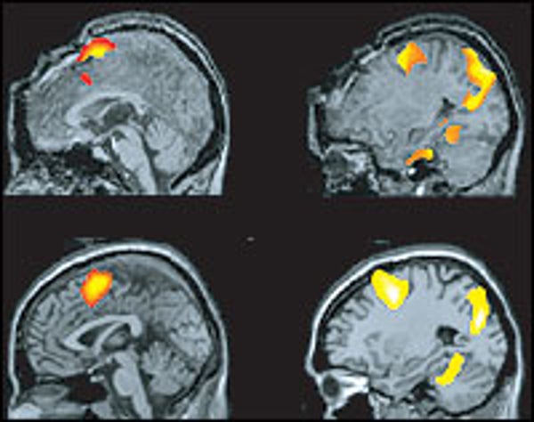 Bid to stop brain test on coma relative