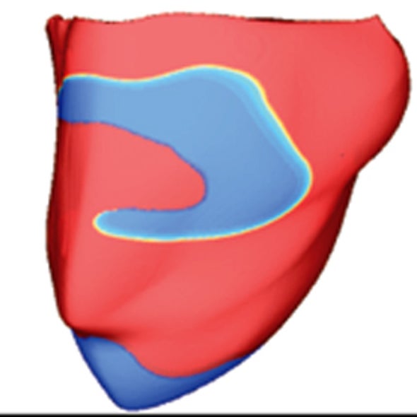 Virtual Ventricle: Computer Predicts Dangers of Arrhythmia Drugs Better than Animal Testing
