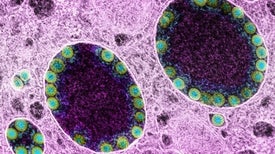 Chronic Covid: The Evolving Story