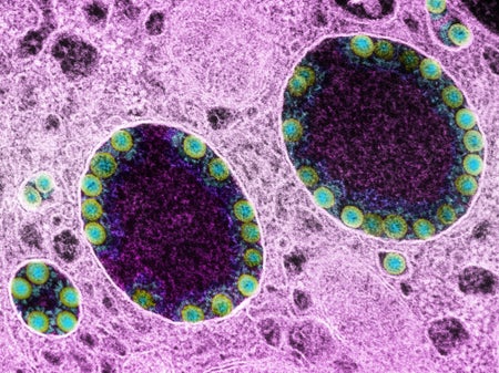 SARS-CoV-2 particles (green) in infected olfactory epithelial cells