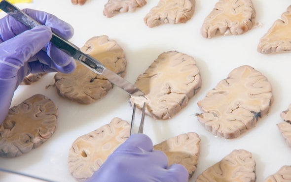 Scientists Start Building a Parts List for the Brain