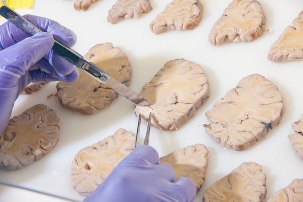 Scientists Start Building a Parts List for the Brain