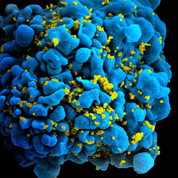HIV Detected in “Cured” Mississippi Baby, Creating Huge AIDS Therapy Setback