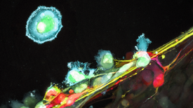 Prize-Winning Images of the Brain