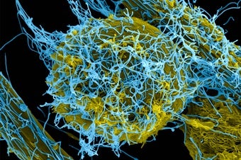 Ebola Vaccine Approved in Europe in Landmark Moment