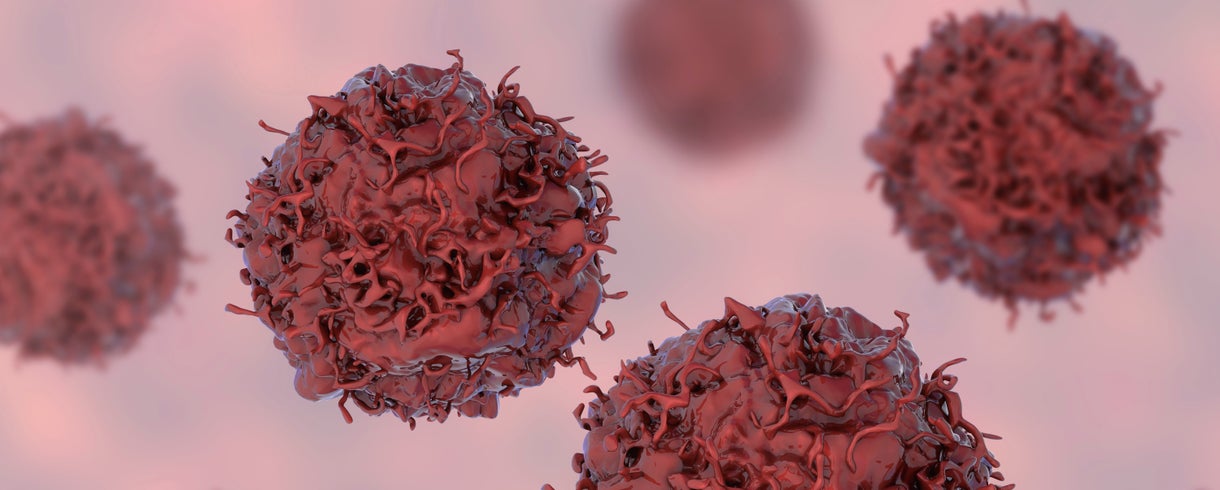 How Can We Change the Future of Lung Cancer Care?