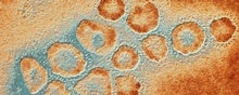 The New Coronavirus Outbreak: What We Know So Far