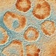Το νέο ξέσπασμα Coronavirus: Αυτό που γνωρίζουμε μέχρι τώρα
