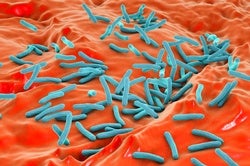 Antimicrobial Resistance Is Growing because of COVID