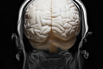 Huge Brain Study Uncovers 