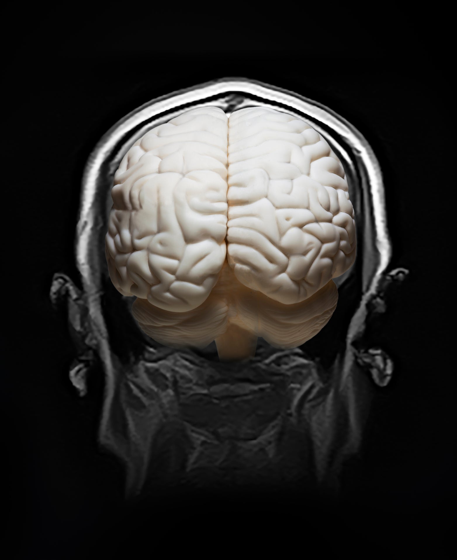 Технология Brain Adapter DARPA.